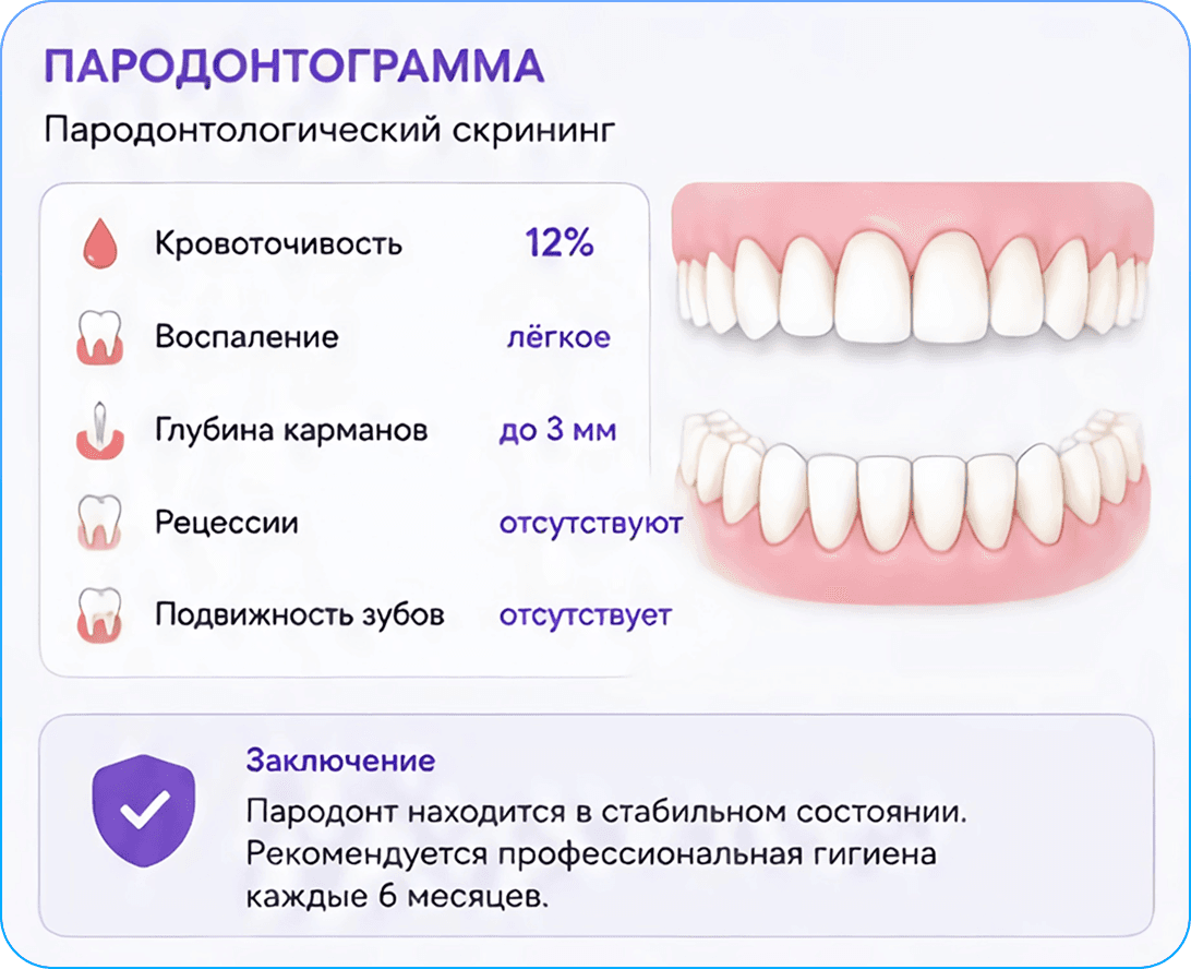 Пародонтограмма