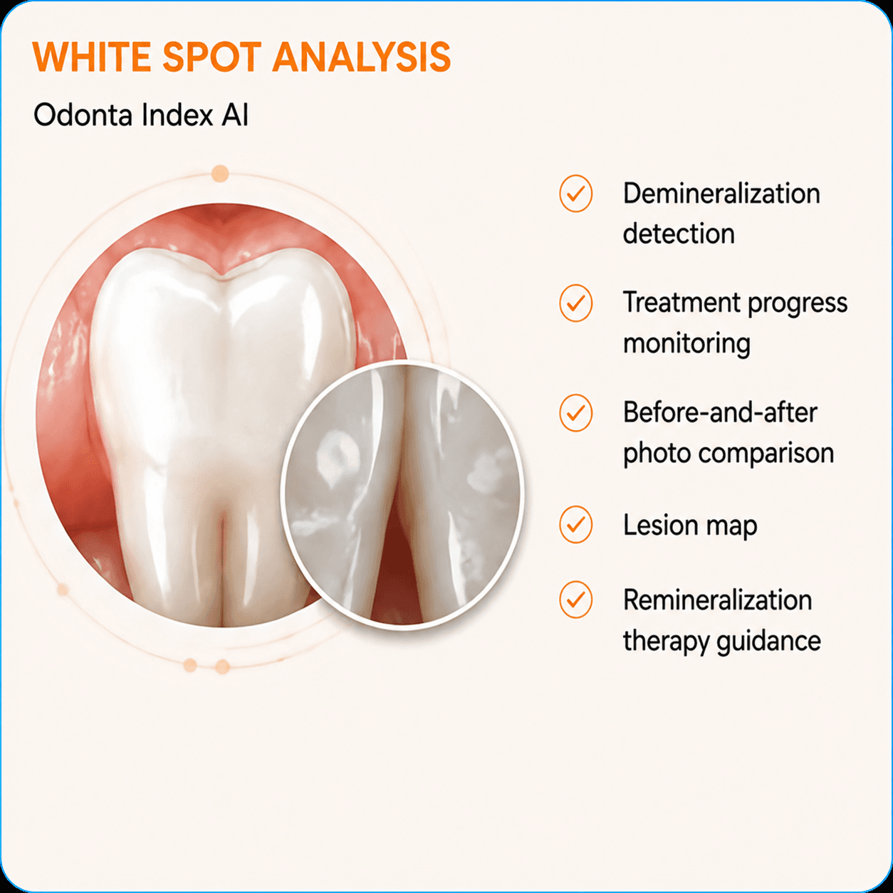 White Spot Analysis